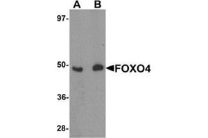 Western blot analysis of FOXO4 in HeLa cell lysate with FOXO4 antibody at (A) 0.