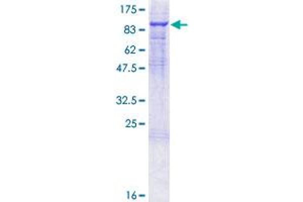 Prothrombin Protein (AA 1-622) (GST tag)