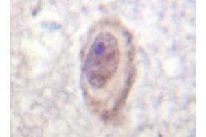 Immunohistochemistry analyzes of C-Raf antibody in paraffin-embedded human brain tissue. (RAF1 antibody)