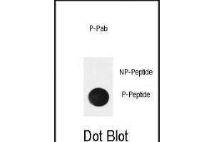 Dot blot analysis of anti-Phospho-NFKBIA (Ser32) Antibody Phospho-specific Pab (ABIN650851 and ABIN2839807) on nitrocellulose membrane.