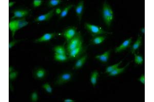 Immunofluorescence staining of Hela cells with ABIN7160821 at 1:133, counter-stained with DAPI. (NLRP1 antibody  (AA 589-655))