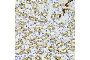 Immunohistochemistry of paraffin-embedded rat kidney using PIK3CA antibody. (PIK3CA antibody  (AA 401-600))