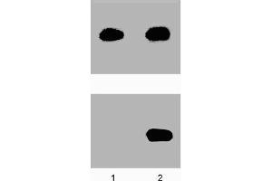 A431 cells were either left untreated (-) or treated (+) with 100 ng/ml EGF for 5 minutes at 37°C. (STAT5A antibody  (pTyr694))