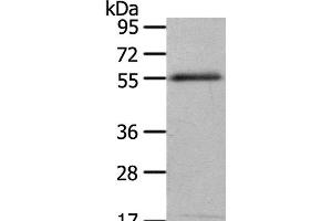 Western Blot analysis of 293T cell using ENPP7 Polyclonal Antibody at dilution of 1:700 (ENPP7 antibody)