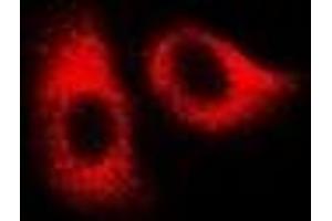 Immunofluorescent analysis of HSPA1L staining in U2OS cells. (HSPA1L antibody)