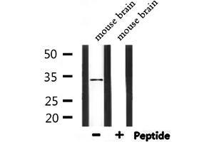 Western blot analysis of extracts from mouse brain, using PIGC Antibody.