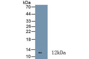 Detection of Recombinant CALPRO, Human using Monoclonal Antibody to Calprotectin (CALPRO) (Calprotectin antibody  (AA 1-114))