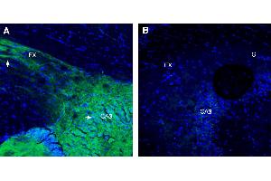 Expression of NMNAT2 in mouse fornixImmunohistochemical staining of perfusion-fixed frozen mouse brain sections with Anti-NMNAT2 Antibody (ABIN7581919), (1:300), followed by goat anti-rabbit-AlexaFluor-488.