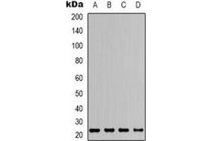 Western blot analysis of ASC expression in HEK293T (A), Raw264. (STS antibody  (N-Term))