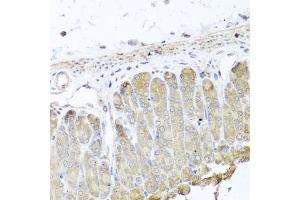 Immunohistochemistry of paraffin-embedded mouse stomach using IRS2 antibody. (IRS2 antibody)