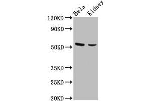 Western Blot Positive WB detected in: Hela whole cell lysate, Mouse kidney tissue All lanes: POLK antibody at 4. (POLK antibody  (AA 227-337))