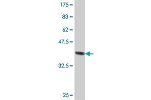 Western Blot detection against Immunogen (37. (NDUFB10 antibody  (AA 73-172))