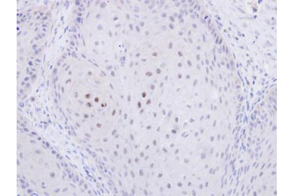 GID8/C20orf11 antibody  (Center)