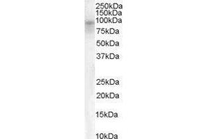 Western Blotting (WB) image for Dipeptidylpeptidase 10 (DPP10) peptide (ABIN368833) (Dipeptidylpeptidase 10 (DPP10) Peptide)