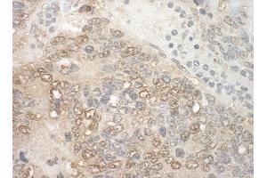 Immunohistochemistry (IHC) image for anti-Zinc Finger, CCHC Domain Containing 11 (ZCCHC11) (AA 250-300) antibody (ABIN7448876) (ZCCHC11 antibody  (AA 250-300))