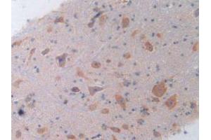 IHC-P analysis of Rat Spinal Cord Tissue, with DAB staining. (IL-4 antibody  (AA 61-111))
