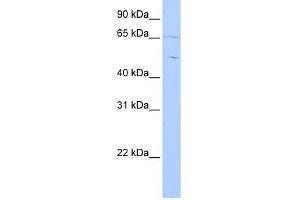 Copine IV antibody used at 1 ug/ml to detect target protein. (Copine IV antibody  (C-Term))