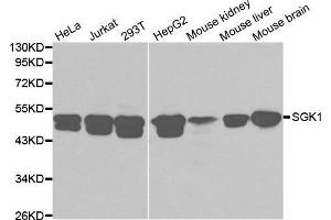 Western blot analysis of extracts of various cell lines, using SGK1 antibody. (SGK1 antibody  (AA 172-431))