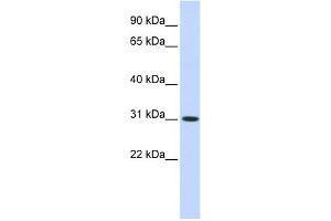 CYB5D2 antibody used at 1 ug/ml to detect target protein. (CYB5D2 antibody  (N-Term))