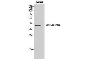 Western Blotting (WB) image for anti-Doublecortin (DCX) (Ser30) antibody (ABIN3184351) (Doublecortin antibody  (Ser30))