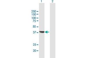 Western Blot analysis of RSAD2 expression in transfected 293T cell line by RSAD2 MaxPab polyclonal antibody. (RSAD2 antibody  (AA 1-361))