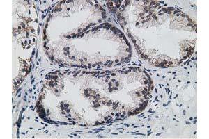 Immunohistochemical staining of paraffin-embedded Human prostate tissue using anti-HPGD mouse monoclonal antibody.