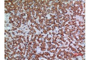Immunohistochemistry (IHC) analysis of paraffin-embedded Human Liver, antibody was diluted at 1:100. (APAF1 antibody  (Internal Region))