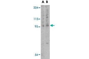 Western blot analysis of TNFAIP3 in rat lung tissue lysate with TNFAIP3 polyclonal antibody  at (A) 1 and (B) 2 ug/mL . (TNFAIP3 antibody  (Internal Region))