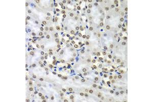 Immunohistochemistry of paraffin-embedded mouse kidney using SEPT7 antibody (ABIN5974146) at dilution of 1/100 (40x lens).