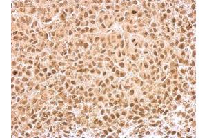 IHC-P Image KLF5 antibody detects KLF5 protein at nucleus on HeLa xenograft by immunohistochemical analysis. (KLF5 antibody)
