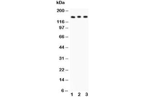 Western blot testing of Insulin Receptor antibody and Lane 1:  rat kidney