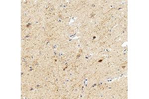 IHC analysis of Calretinin/CALB2 using anti-Calretinin/CALB2 antibody (ABIN7602106). (Calretinin antibody  (AA 59-90))