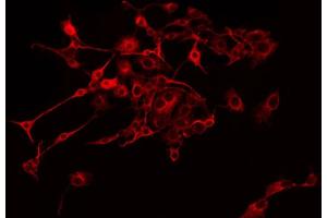 ABIN6275274 staining COLO205 by IF/ICC. (NDUFB9 antibody  (Internal Region))