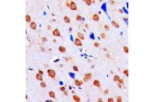 Immunohistochemical analysis of CHK1 (pS317) staining in human brain formalin fixed paraffin embedded tissue section. (CHEK1 antibody  (pSer317))