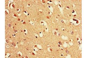 Immunohistochemistry of paraffin-embedded human brain tissue using ABIN7169128 at dilution of 1:100 (PAK3 antibody  (AA 70-190))