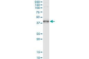 Immunoprecipitation of XPA transfected lysate using anti-XPA MaxPab rabbit polyclonal antibody and Protein A Magnetic Bead , and immunoblotted with XPA purified MaxPab mouse polyclonal antibody (B01P) . (XPA antibody  (AA 1-273))