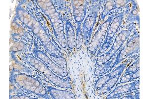 anti-Chemokine (C-C Motif) Ligand 14 (CCL14) (Internal Region) antibody
