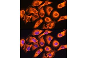 Immunofluorescence analysis of U20S cells using Rig-I/DDX58 antibody (ABIN6130263, ABIN6139513, ABIN6139515 and ABIN6217394) at dilution of 1:100. (DDX58 antibody  (AA 726-925))