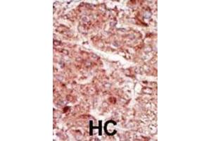 Immunohistochemistry (IHC) image for anti-Hexokinase 3 (White Cell) (HK3) antibody (ABIN3003707)