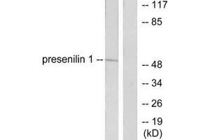 Western Blotting (WB) image for anti-Presenilin 1 (PSEN1) (N-Term) antibody (ABIN1848749) (Presenilin 1 antibody  (N-Term))