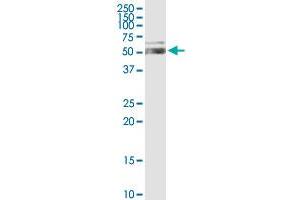ALDH1A1 MaxPab rabbit polyclonal antibody. (ALDH1A1 antibody  (AA 1-501))
