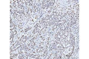 IHC analysis of MCM6 using anti-MCM6 antibody (ABIN7600037).