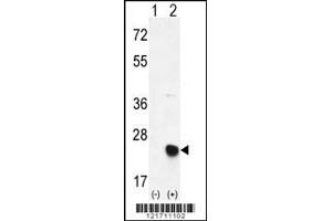 Western blot analysis of MSRB2 using rabbit polyclonal MSRB2 Antibody using 293 cell lysates (2 ug/lane) either nontransfected (Lane 1) or transiently transfected (Lane 2) with the MSRB2 gene.