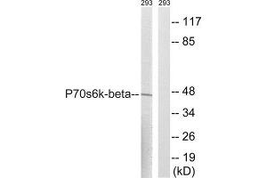 Western Blotting (WB) image for anti-Ribosomal Protein S6 Kinase, 70kDa, Polypeptide 2 (RPS6KB2) (Ser423) antibody (ABIN1848245) (RPS6KB2 antibody  (Ser423))