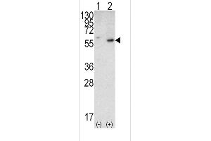 PTEN antibody  (N-Term)