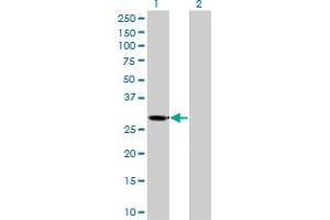 Western Blotting (WB) image for anti-Ketohexokinase (KHK) (AA 1-299) antibody (ABIN598769) (Ketohexokinase antibody  (AA 1-299))