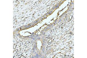 IHC analysis of HUPF2/RENT2/UPF2 using anti-HUPF2/RENT2/UPF2 antibody (ABIN7600567).