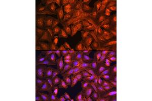Immunofluorescence (IF) image for anti-LIM and SH3 Protein 1 (LASP1) (AA 130-205) antibody (ABIN1680664)