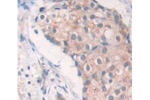 Used in DAB staining on fromalin fixed paraffin- embedded Kidney tissue (SRPK3 antibody  (AA 247-517))