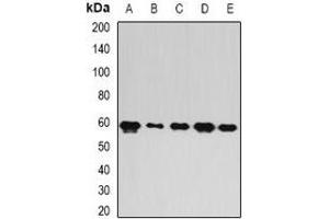 Western blot analysis of FIR expression in A549 (A), mouse brain (B), mouse spleen (C), rat lung (D), rat liver (E) whole cell lysates.